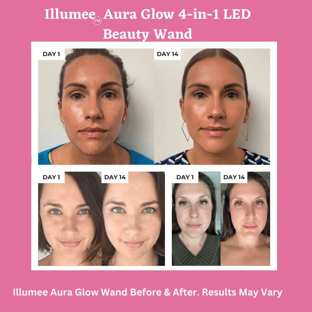 Illumee™ Aura Glow 4-in-1 LED Beauty Wand