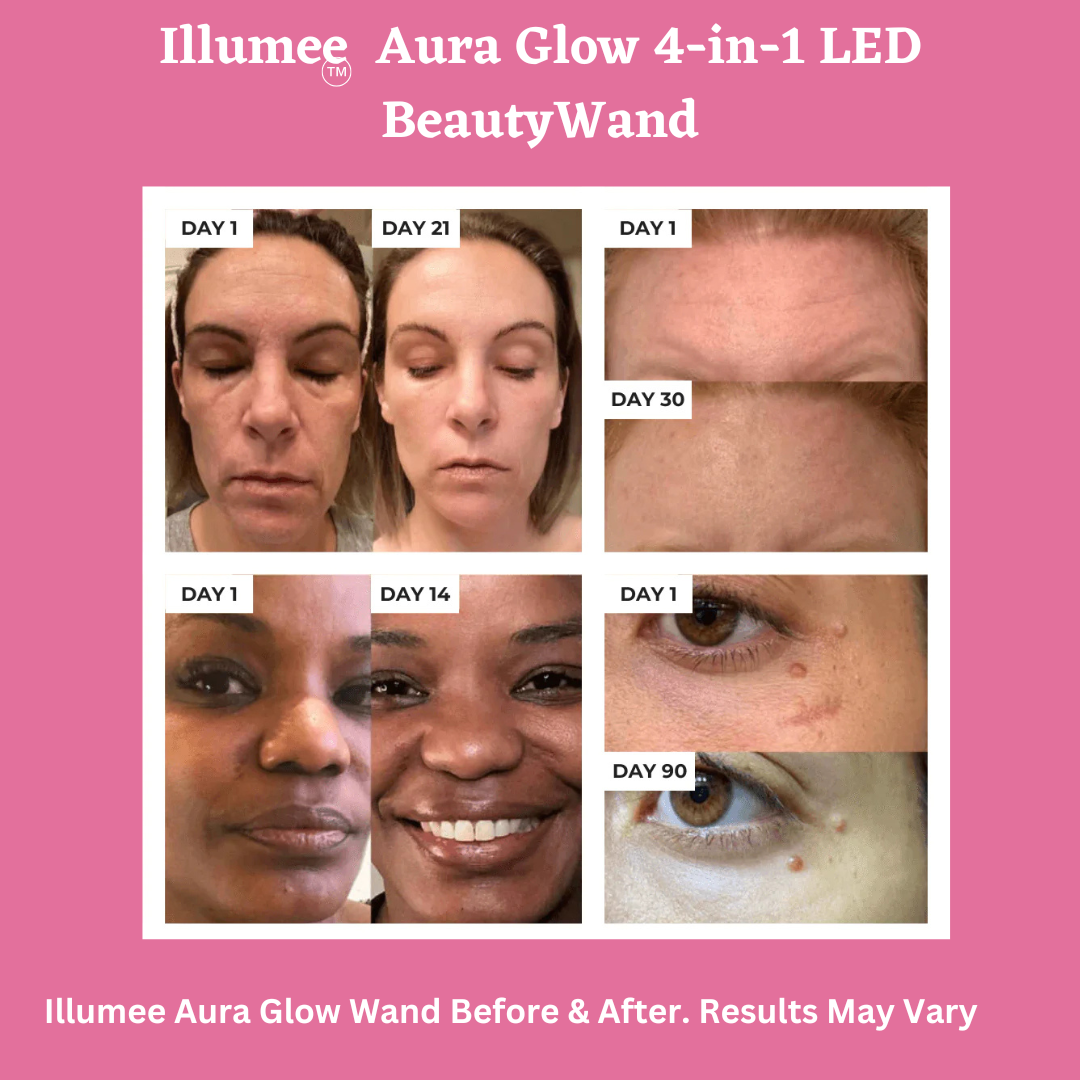 Illumee™ Aura Glow 4-in-1 LED Beauty Wand