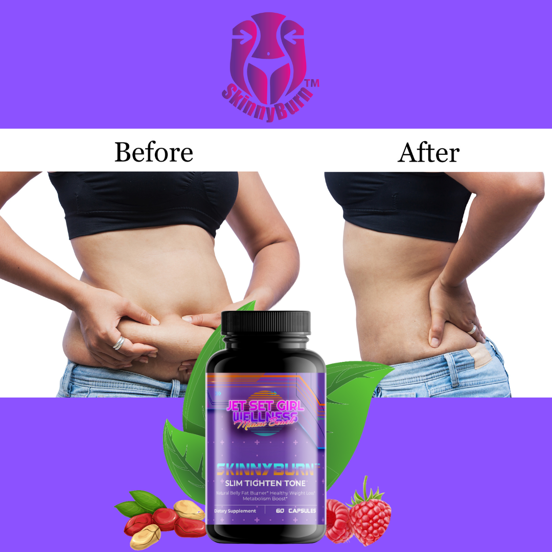 SkinnyBurn™ Slim | Tighten | Tone Burn Fat, ayuda a la transformación del bienestar del peso, 60 unidades